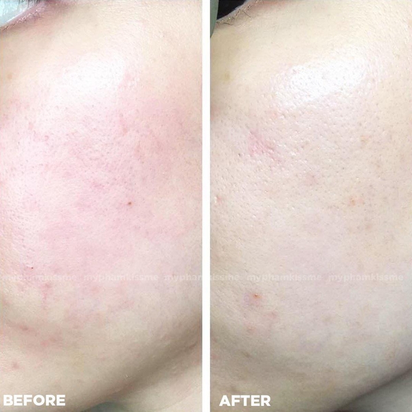 Serum keo ong CNP Laboratory