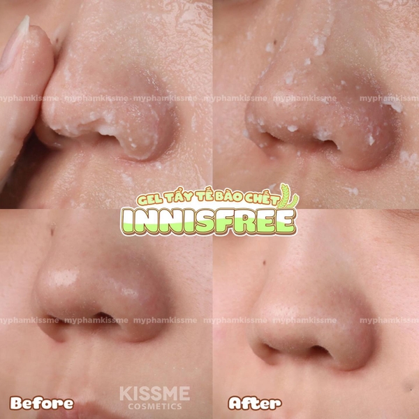 Tẩy Da Chết Innisfree Green Barley Gommage Peeling Mask