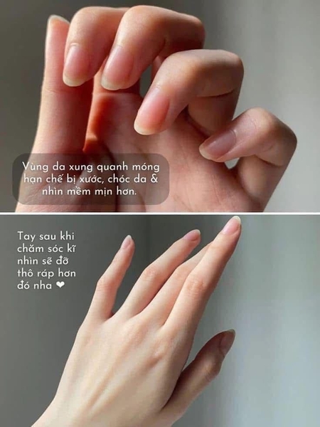 Kem dưỡng tay ẩm mịn Q10