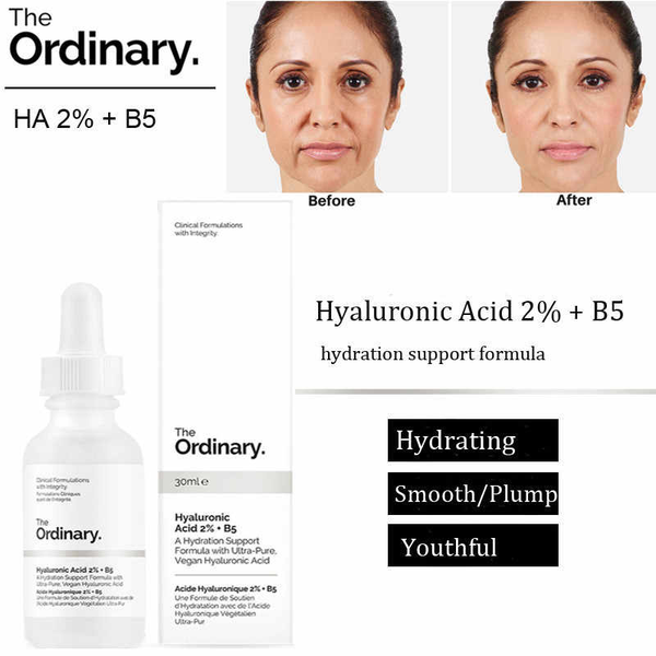 Serum cấp ẩm phục hồi The Ordinary Hyaluronic B5 30ml