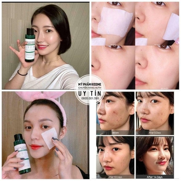 Toner Tẩy Da Chết AHA-BHA-PHA Some By Mi 30 Days Miracle Toner 150ml