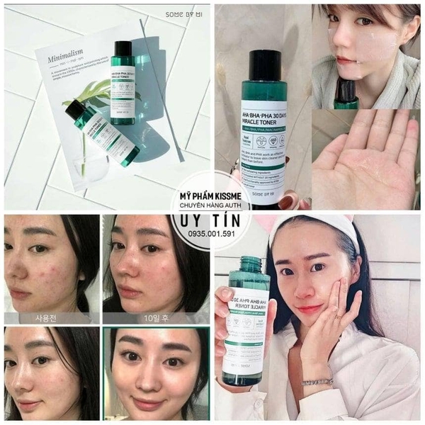 Toner Tẩy Da Chết AHA-BHA-PHA Some By Mi 30 Days Miracle Toner 150ml