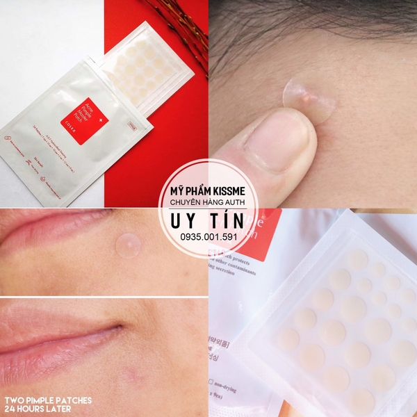 Miếng Dán Mụn Cosrx Acne Pimple Master Patch