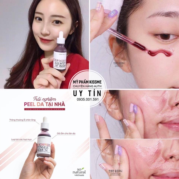 Tinh Chất Tẩy Da Chết Hóa Học So' Natural Red Peel Tingle Serum