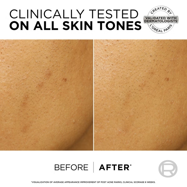 Peel da Loreal hồng Glycolic Bright Exfoliant Peel