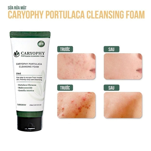 Sữa rửa mặt Sạch Sâu, Phục Hồi Da Caryophy Portulaca Cleansing Foam