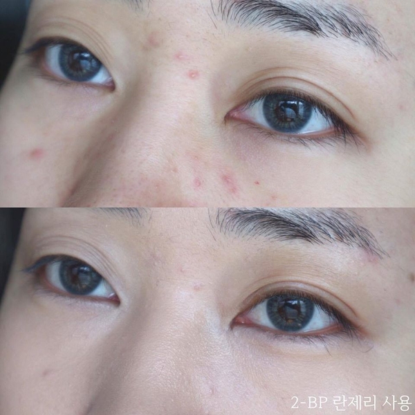 Che Khuyết Điểm Clio Kill Cover Airy Fit