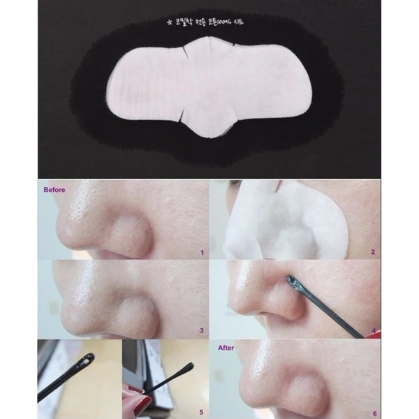 Miếng dán đẩy mụn Goodbye Blackhead