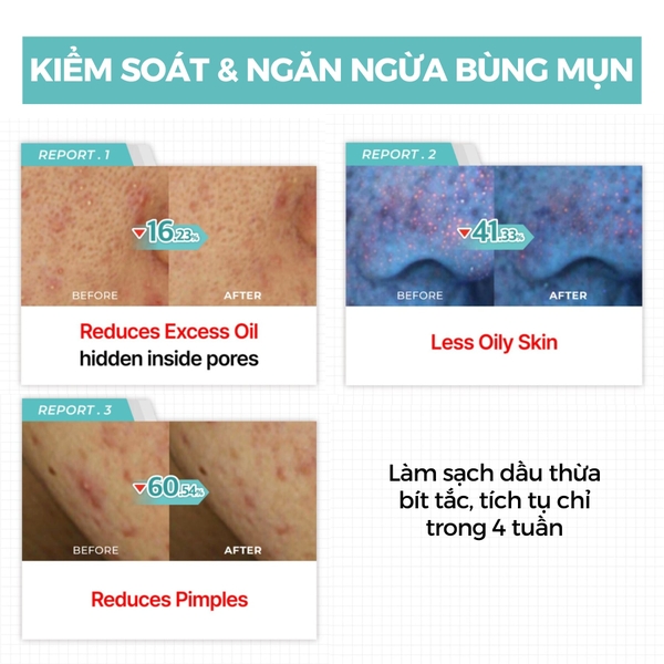 Kem dưỡng Numbuzin Pantothenic B5 Active Soothing Cream