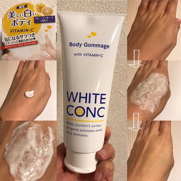 Tẩy Tế Bào Chết Toàn Thân White Conc