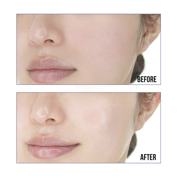 Serum tái tạo Phục Hồi Da Sur.Medic Peptide