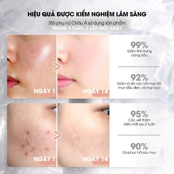 Serum 15% Niacinamide Giảm Mụn Dưỡng Sáng Da Neogen Dermalogy Real Niacinamide Firming