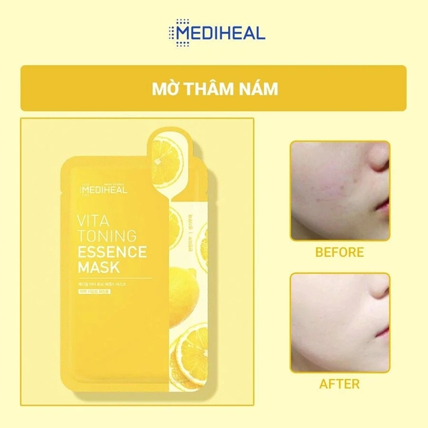 Mặt Nạ Cấp Ẩm, Dưỡng Sáng Da, Ngừa Lão Hóa Cao Cấp Mediheal Mask 20ml