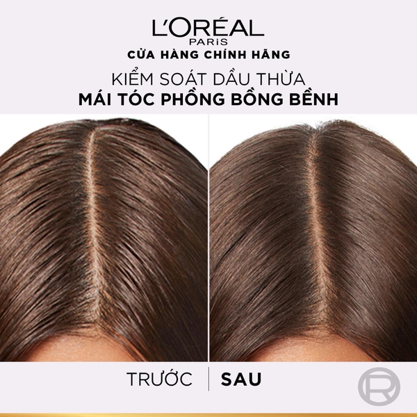 Bộ gội xả L'Oreal Elseve 72H HA Pure cho da đầu dầu và da đầu khô
