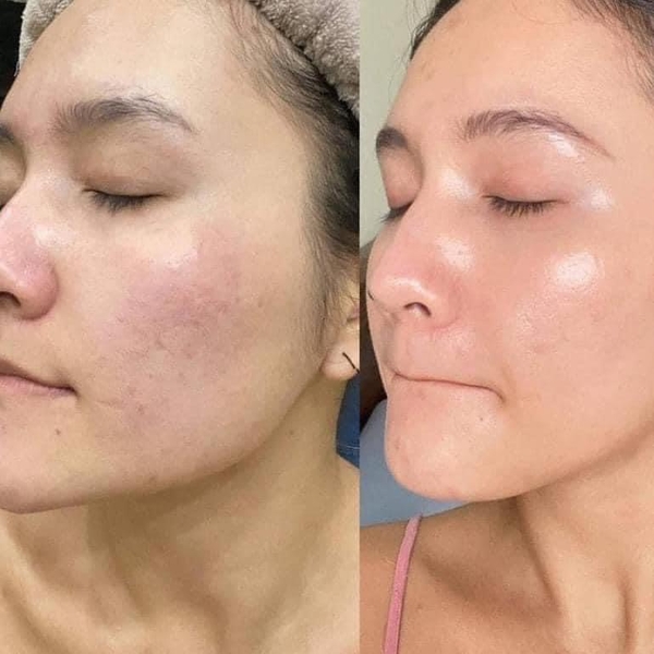 Kem dưỡng chống lão hóa căng bóng da Obagi Retinol
