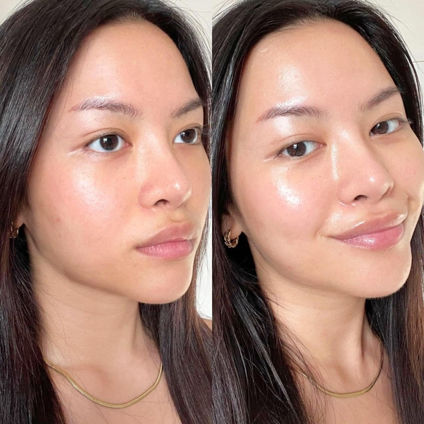 Kem dưỡng siêu cấp ẩm & giảm nếp nhăn L'Oreal Paris Revitalift Hyaluronic Acid 50ml