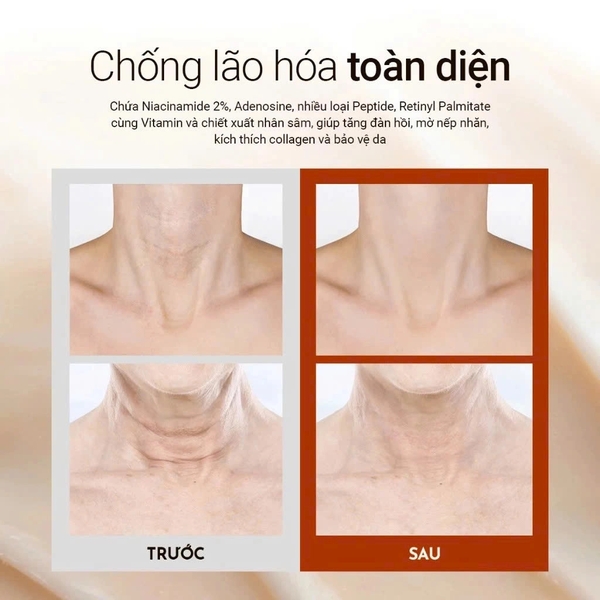 Kem Dưỡng Chống Lão Hoá Vùng Da Cổ Vella Neck Cream Ultimate Age Killer