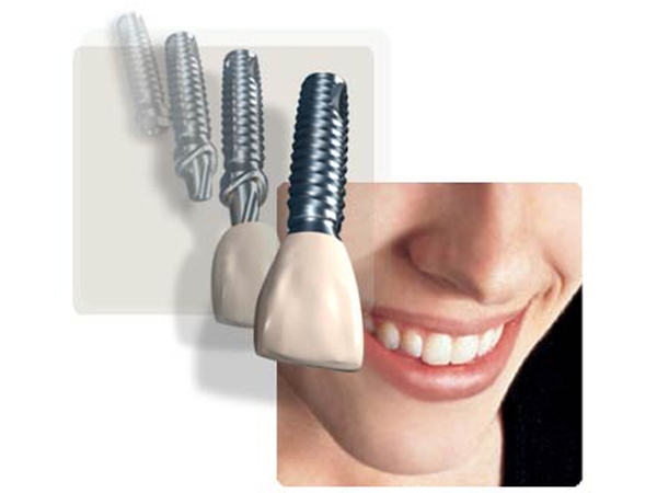 Triển lãm nha khoa nhân dịp 115 năm thành lập Trường Đại Học Y Hà Nội