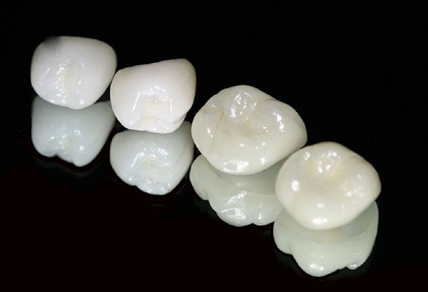 Bọc răng sứ thẩm mỹ Zirconia