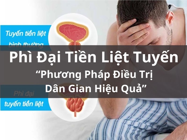 Phì Đại Tiền Liệt Tuyến Và Phương Pháp Điều Trị Dân Gian Hiệu Quả