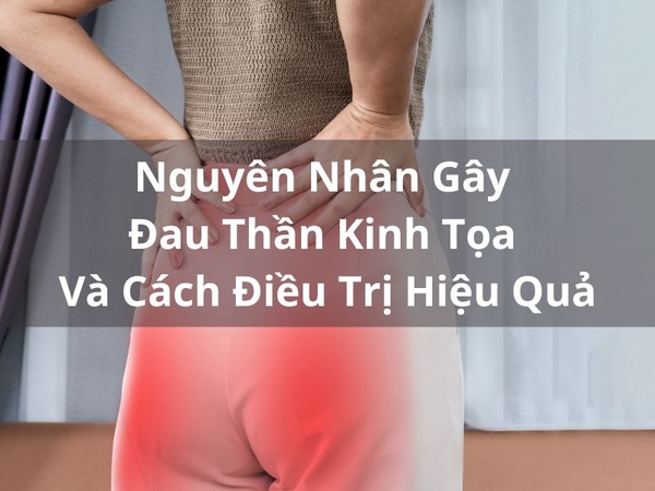 Top 5 Sản Phẩm Hỗ Trợ Đau Khớp Hiệu Quả Nhất 2024