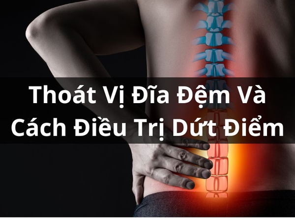 Thoát Vị Đĩa Đệm Và Cách Điều Trị Dứt Điểm