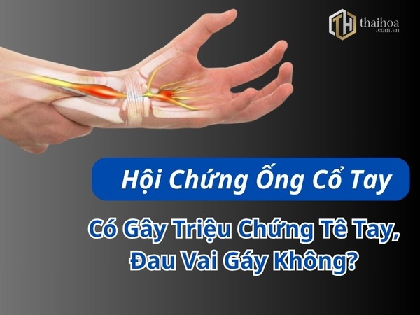 Bị Tê Tay, Đau Vai Gáy Có Phải Triệu Chứng Của Hội Chứng Ống Cổ Tay Không?