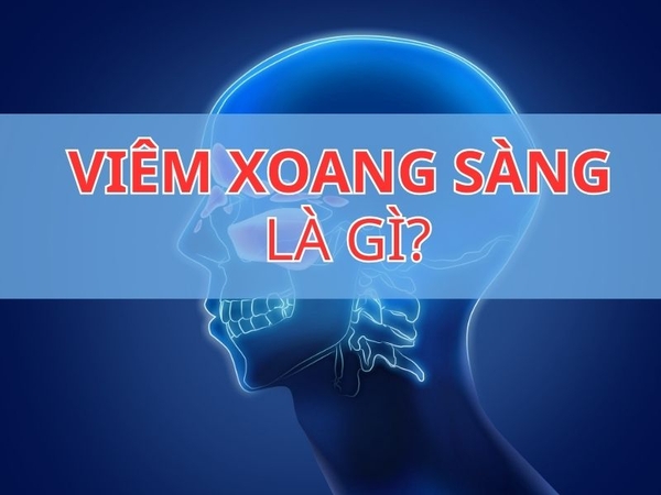 Viêm Xoang Sàn: Hiểu Đúng Để Chăm Sóc Sức Khỏe Hiệu Quả