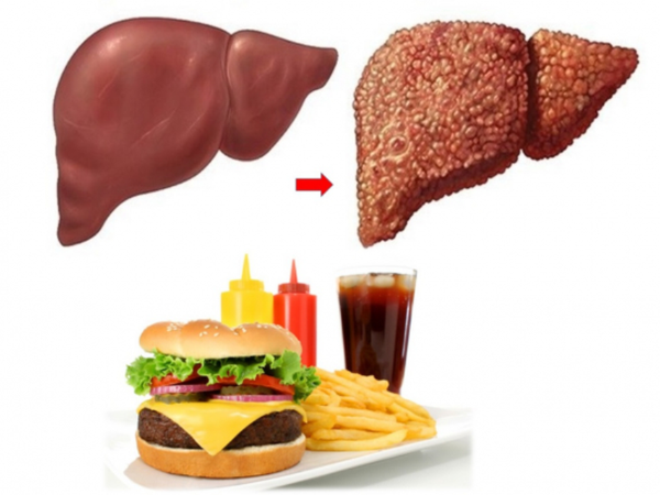 5 THỰC PHẨM HẠI GAN HƠN CẢ BIA RƯỢU , BẠN ĐÃ BIẾT CHƯA?