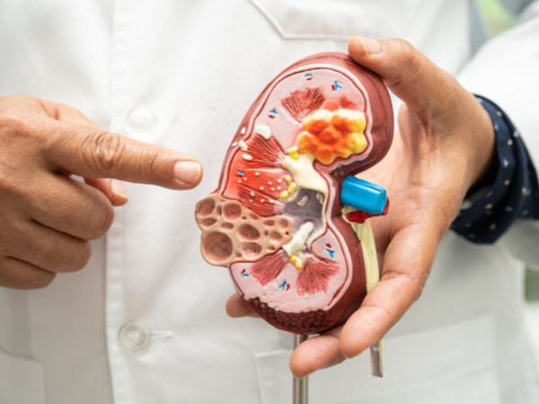 7 thói quen gây hại thận trầm trọng nhiều người dễ mắc phải