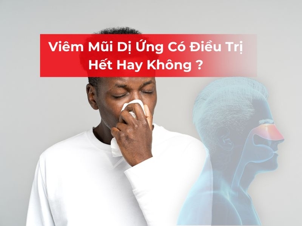 Viêm Mũi Dị Ứng Có Điều Trị Hết Hay Không ?