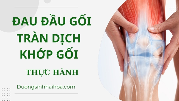 ĐAU ĐẦU GỐI - TRÀN DỊCH KHỚP GỐI ( THỰC HÀNH )