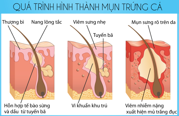Dùng nhiều loại thuốc cùng một lúc