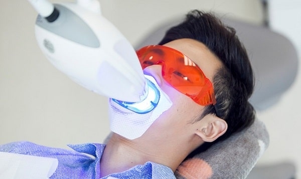 Nên tẩy trắng răng tại nhà hay tới nha khoa?
