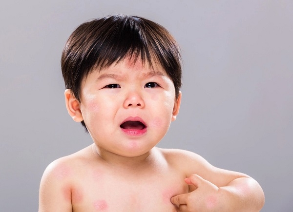 Nhận biết bé bị dị ứng sữa
