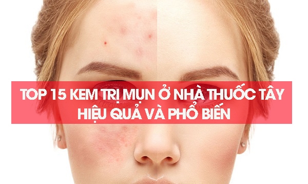 Top 15 kem trị mụn ở nhà thuốc tây hiệu quả và phổ biến