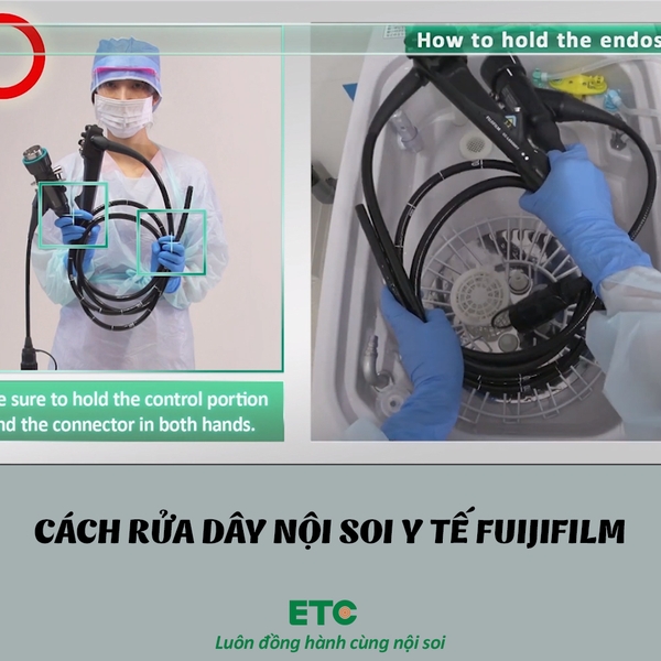 CÁCH RỬA DÂY NỘI SOI Y TẾ FUIJIFILM