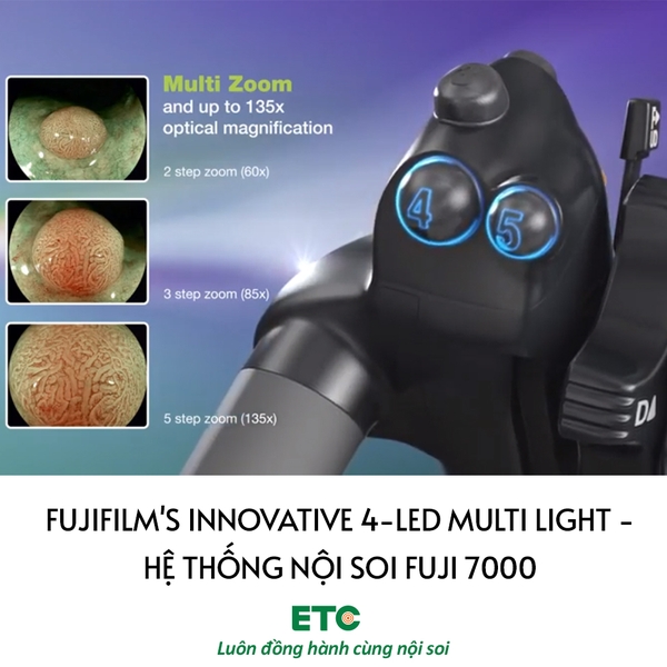 Fujifilm's innovative 4-LED Multi Light - Hệ thống nội soi Fuji 7000