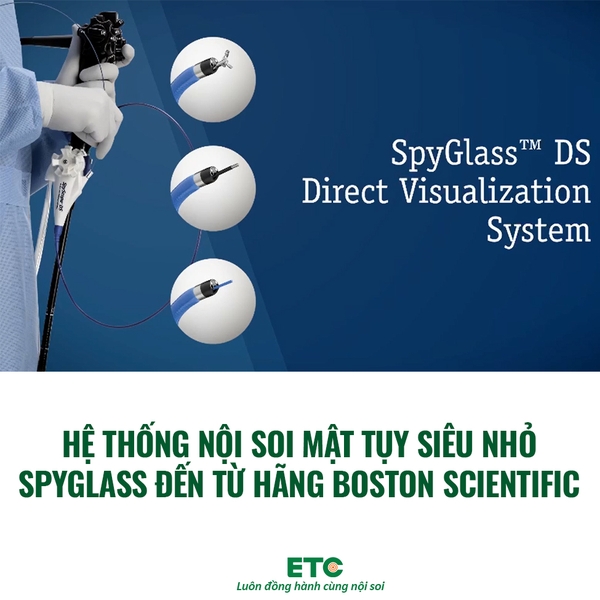 Hệ Thống Nội Soi Mật Tụy Siêu Nhỏ Spyglass