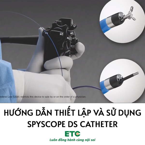 Set up and Use of the SpyGlass - Hướng dẫn thiết lập và sử dụng SpyScope DS Catheter - Thiết bị nội soi tiêu hóa ETC (fujifilm)