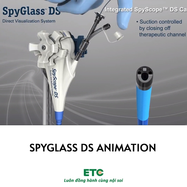 SpyGlass DS Animation - Thiết bị nội soi tiêu hóa ETC (fujifilm)