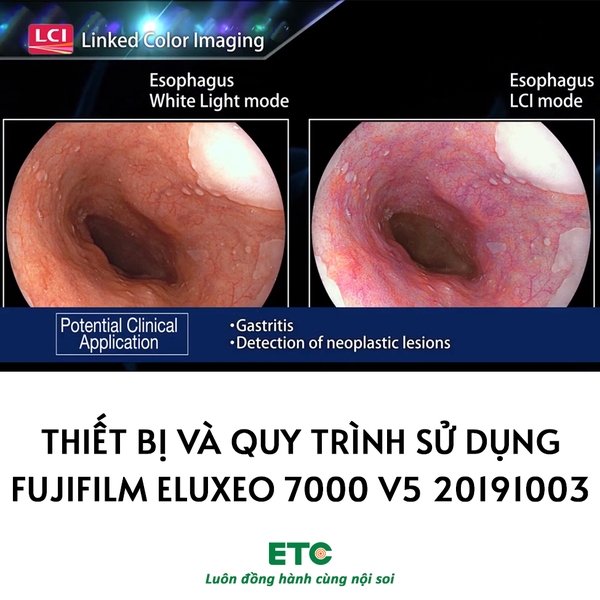 Thiết bị và quy trình sử dụng Fujifilm Eluxeo 7000 V5 20191003