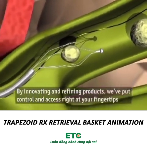 Trapezoid RX Retrieval Basket Animation - Thiết bị nội soi y tế ETC (Fujifilm)