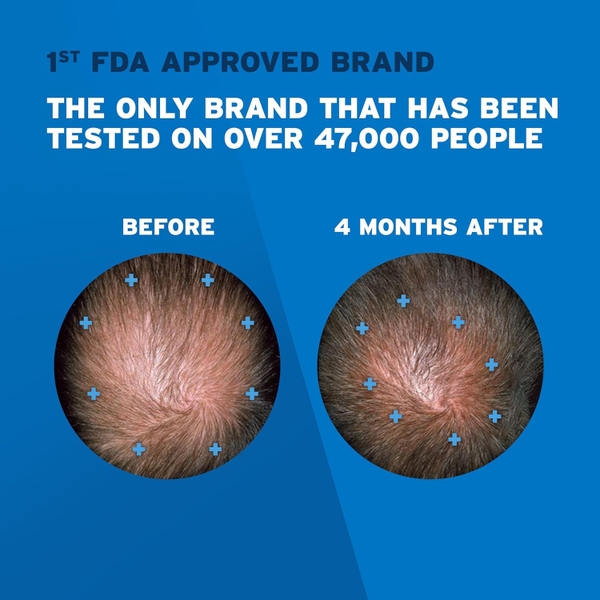 Phục hồi tóc cho nam giới Rogaine Extra Strength 5% Minoxidil Topical Solution for Hair Regrowth, 60ml