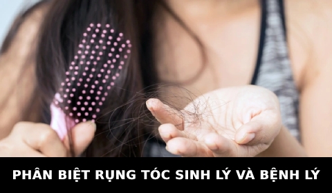 CÁCH PHÂN BIỆT RỤNG TÓC SINH LÝ VÀ RỤNG TÓC BỆNH LÝ