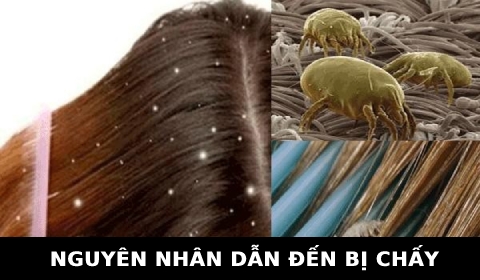 TẠI SAO BỊ CHẤY? (KIẾN THỨC THỢ TÓC CẦN NẮM)