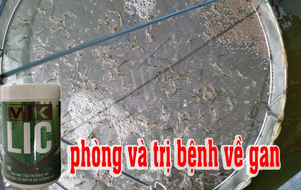 NGUYÊN NHÂN VÀ GIẢI PHÁP VỀ BỆNH GAN ?
