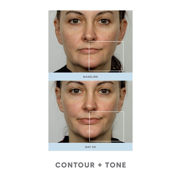 Máy massage nâng cơ NuFace Trinity