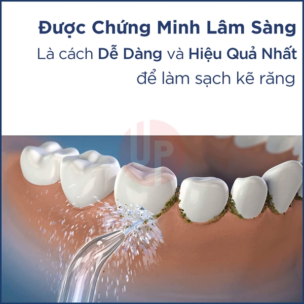 Máy tăm nước không dây Waterpik WP-462 PLUS (Màu đen)