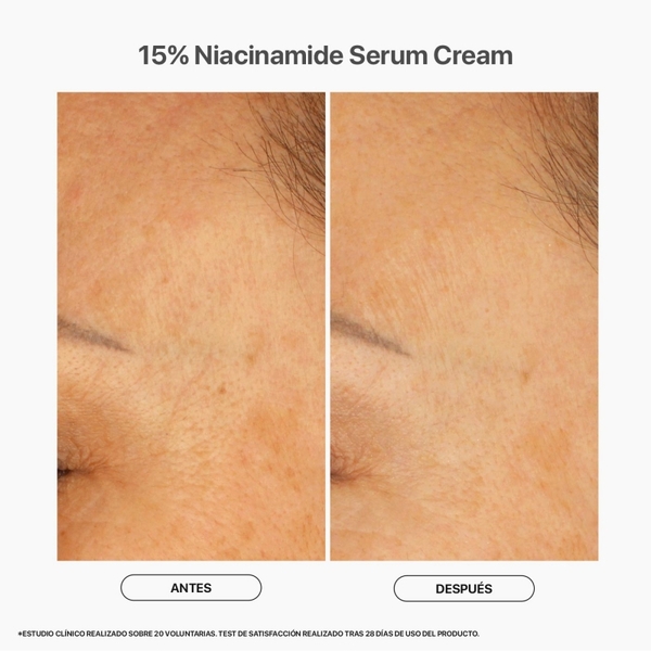 LACABINE 15% NIACINAMIDE SERUM CREAM / TINH CHẤT DƯỠNG SÁNG, MỜ THÂM DA